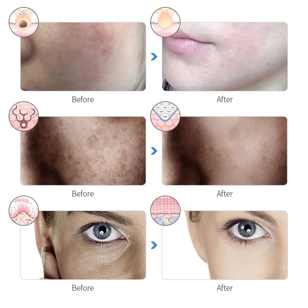 LumiGlow Therapy - LED Skin Rejuvenation Mask